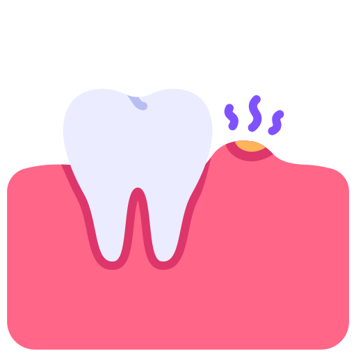 I need surgery in my mouth